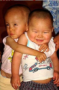 China Care Babies