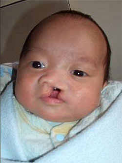 Zhao Yan Lu before the surgery